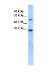 NBP1-54947 - Carbonic anhydrase 8